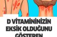 D Vitamini Eksikliğiniz Olduğunu Gösteren 10 Belirgin İşaret