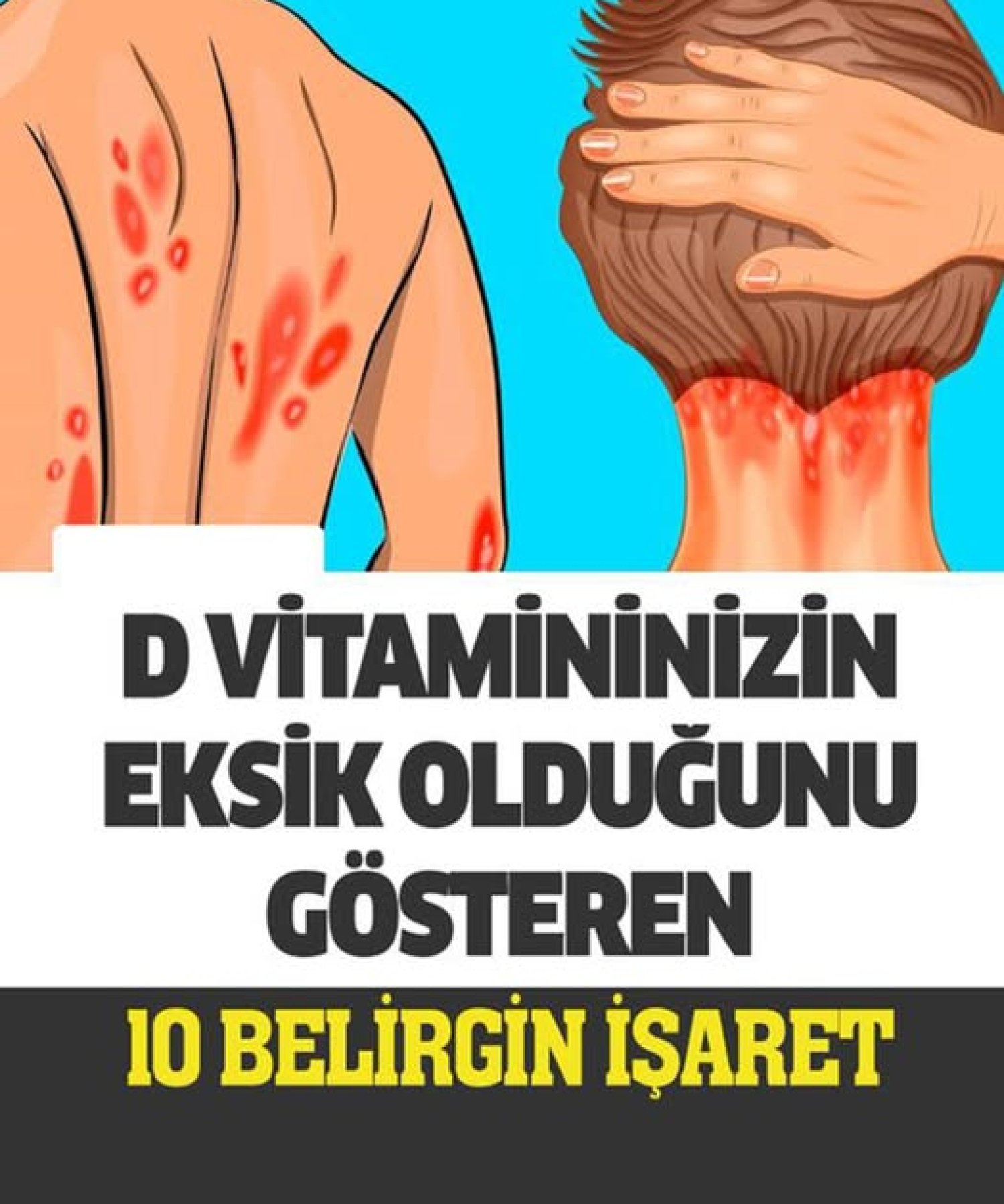 D Vitamini Eksikliğiniz Olduğunu Gösteren 10 Belirgin İşaret
