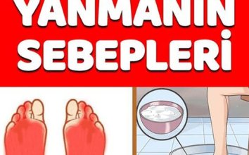 Ayaklarda Yanma Sebepleri