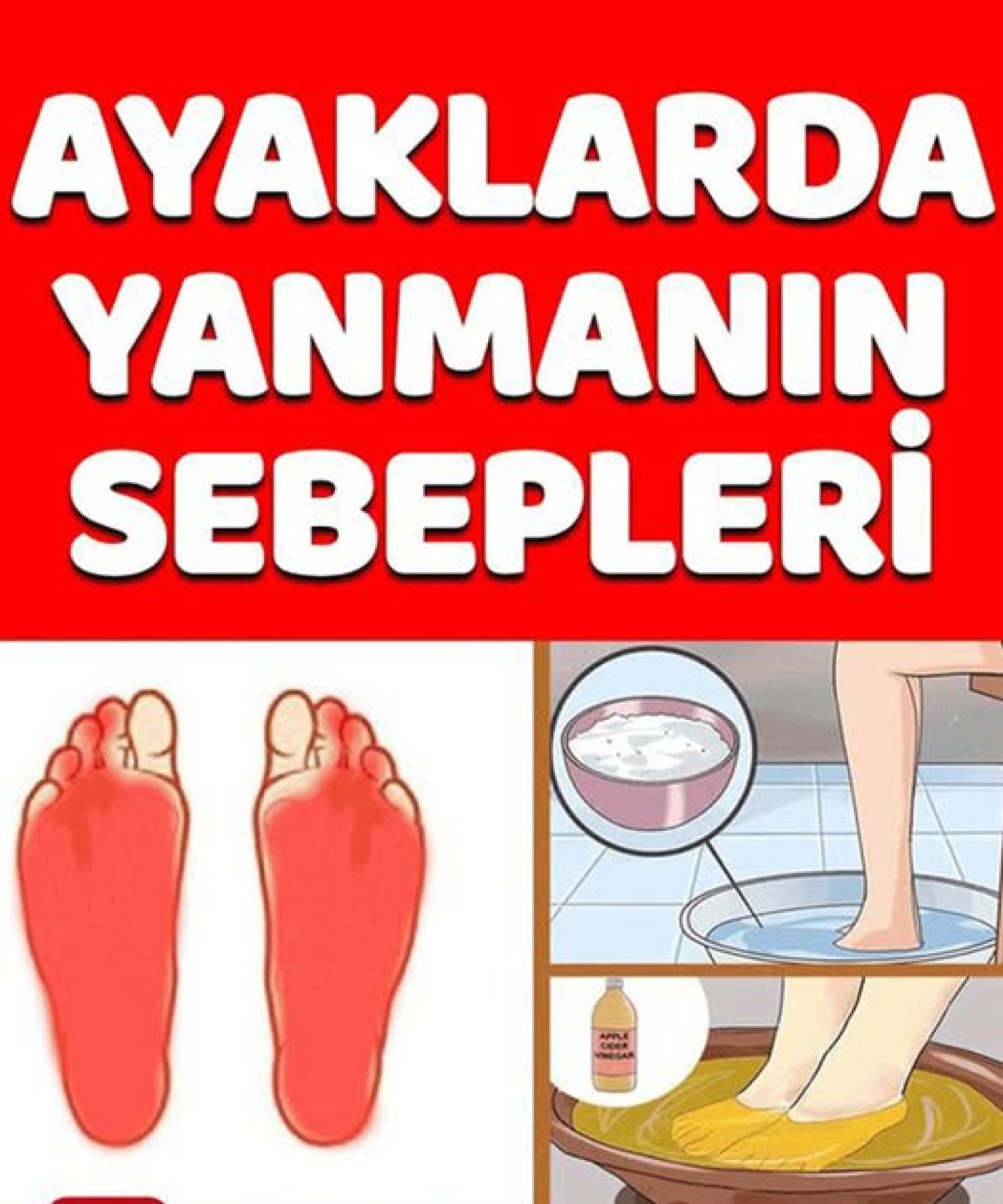 Ayaklarda Yanma Sebepleri