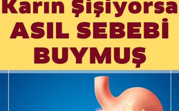 Mide Şişkinliği Ve Hazımsızlığın Asıl Sebebi