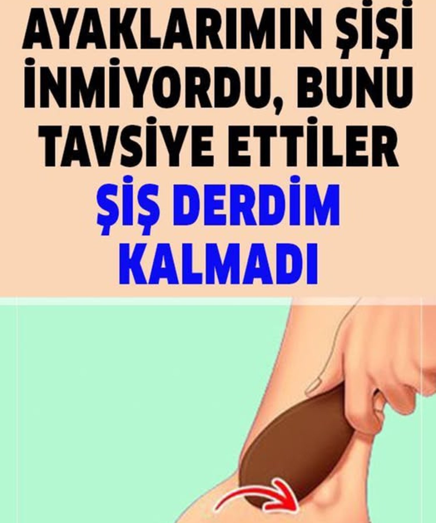 Şişmiş Ayaklar İçin Ne Yapılmalı?