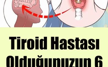 Tiroid Hastası Olduğunuzun 6 Saklı İşareti