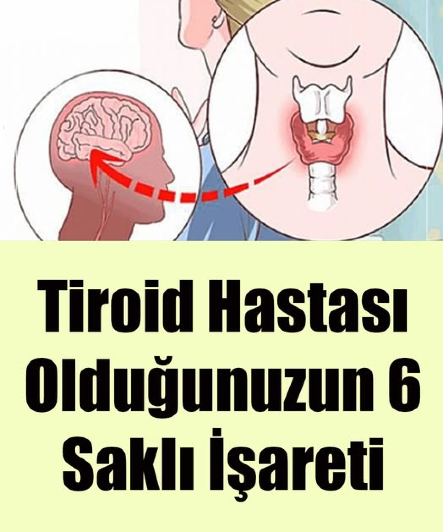 Tiroid Hastası Olduğunuzun 6 Saklı İşareti