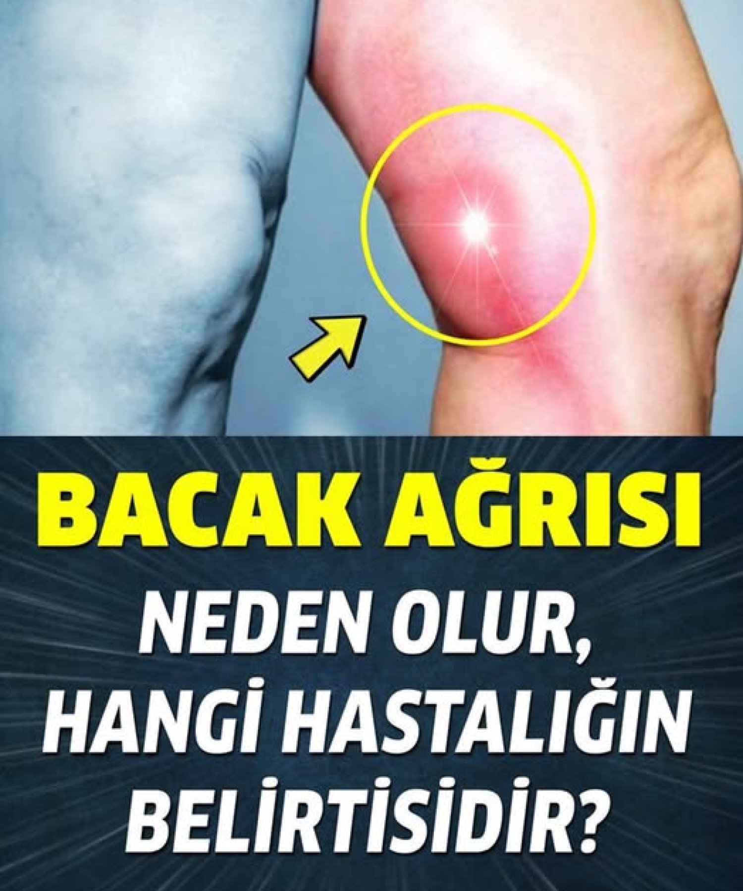 Bacak ağrısı neden olur, neyin belirtisi
