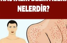 Yağlı Karaciğer Hastalığı Belirtileri