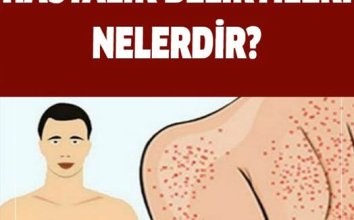 Yağlı Karaciğer Hastalığı Belirtileri