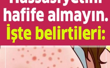 Gluten Hassasiyetini Hafife Almayın İşte Belirtileri