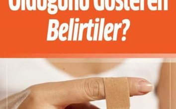 D Vitaminin Eksikliğini Gösteren Belirtiler