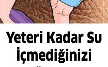 Yeteri kadar su içmediğinizde başınıza bunlar gelir..
