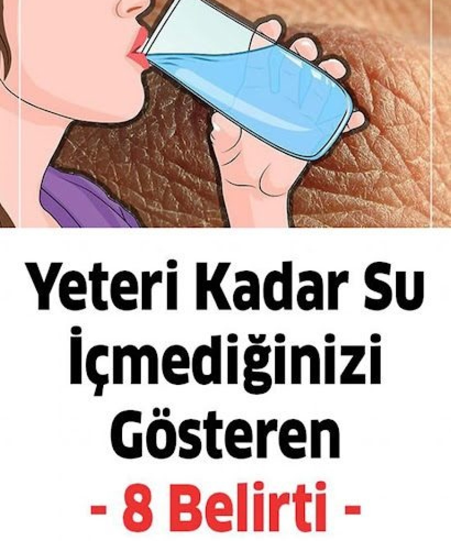 Yeteri kadar su içmediğinizde başınıza bunlar gelir..