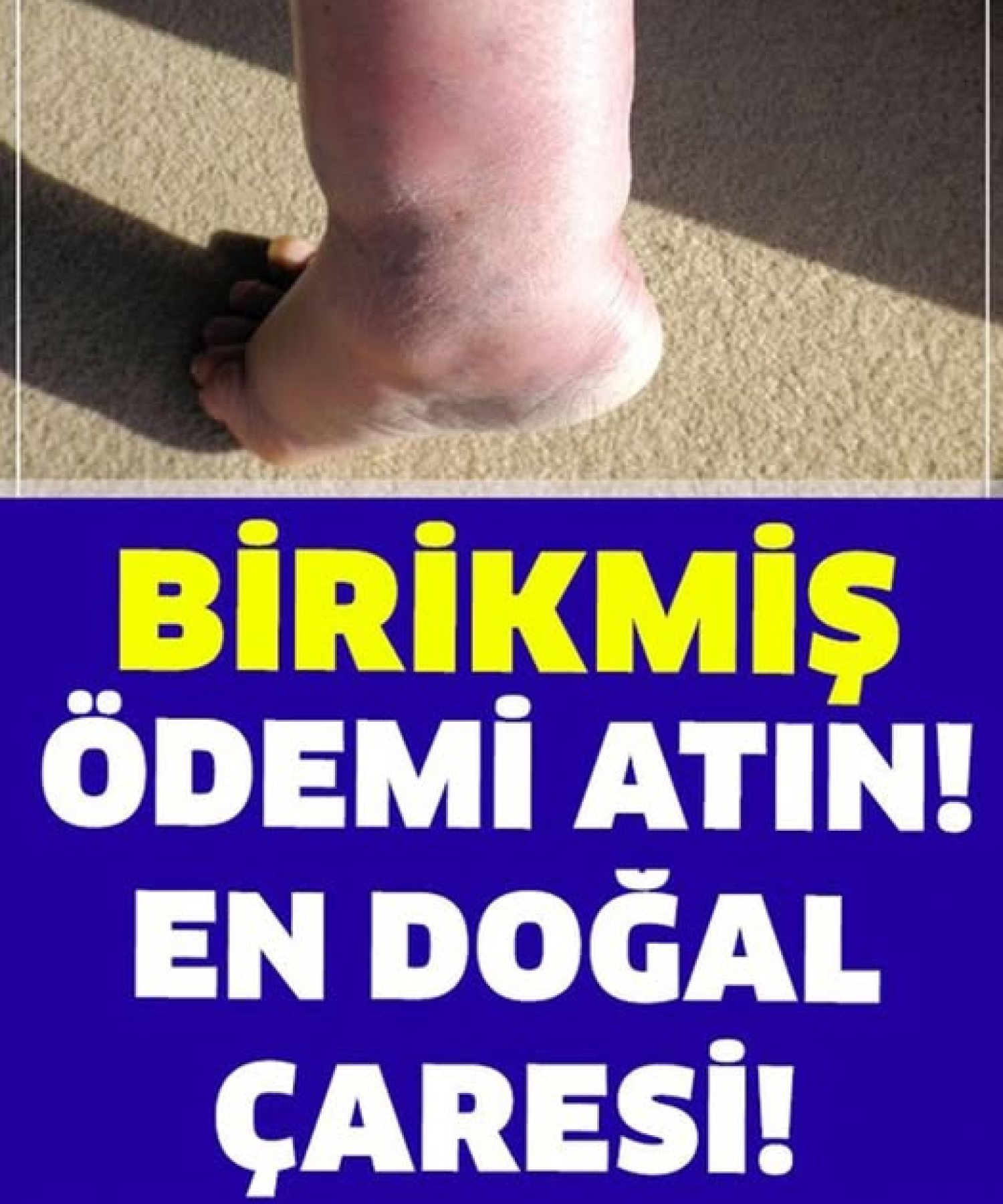 Bedeninizdeki Birikmiş Ödemi Atmak Ne Kadar Faydalı?