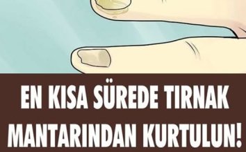 Tırnak Mantarına Doğal Çözümler