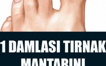 Basit Bir Yöntemle Tırnak Mantarından Kurtulun